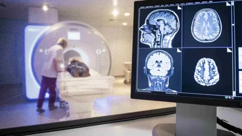 Science Photo Library MRI scanning