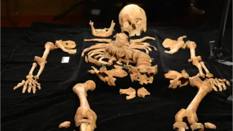 BBC Richard III's bones