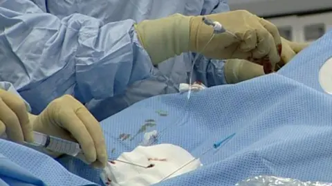 Heart surgery in progress