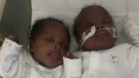 Covid-19: Twins delivered in Birmingham while mother in coma - BBC News