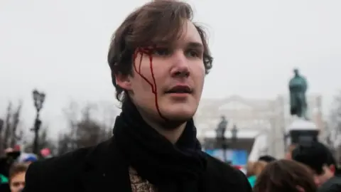 Reuters A pro-Nalavany protester is seen with blood on his head in Moscow protest