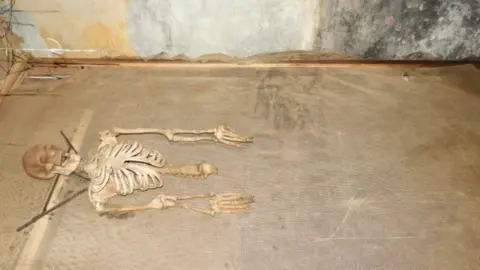 Gilbert Baitson Exhibit of skeleton in a grave