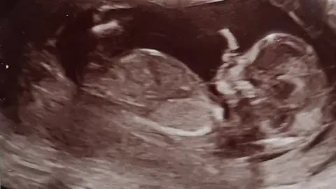 Carla Fitzgerald baby scan