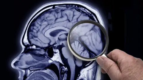 Getty Images Researching the brain with a magnifying glass