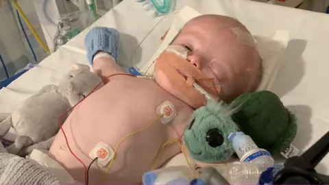 Brain tumour research Roux in hospital
