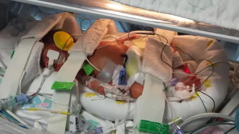 Submitted A tiny baby is attached to various tubes and monitors inside an incubator in hospital 