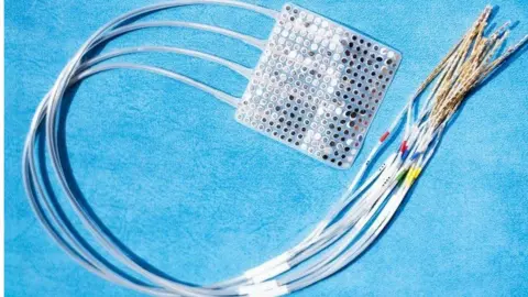 UCSF Electrodes