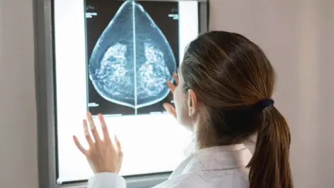 Getty Images Doctor looking at breast scan