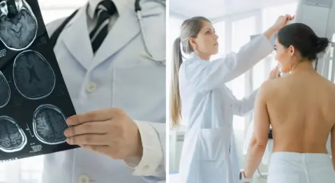 Getty Images Stroke consultant and breast cancer patient