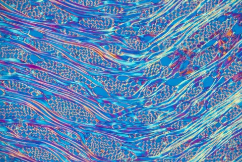 Steve Lowry A microscopic view showing tree cells in blue and purple colours