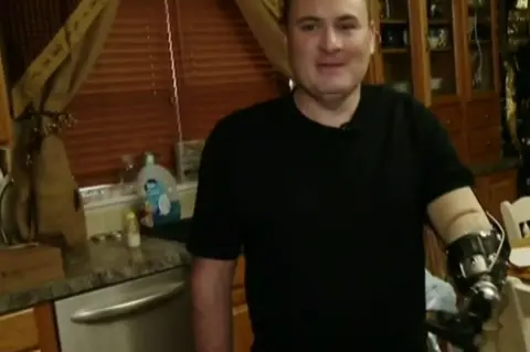 CBS The oficer shows his prosthetic arm after the accident