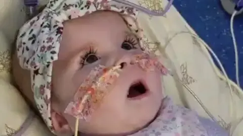 Gofundme Indi lying down with feeding tubes in her nose