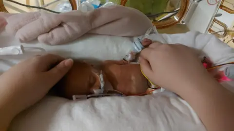 Angel-Kay Mason Baby Aria in a cot covered in tubes and wires in the Neonatal Intensive Care Unit with her mother's hands stroking her head and legs