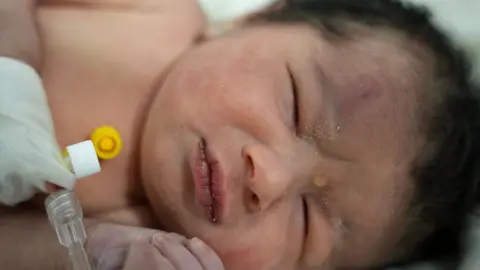 AFP A newborn baby pulled from the rubble of a destroyed building in Jindayris, Syria, receives treatment at a hospital (7 February 2023)