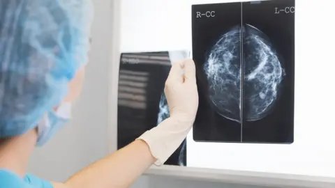 Getty Images Doctor holds up a mammogram in front of an x-ray illuminator