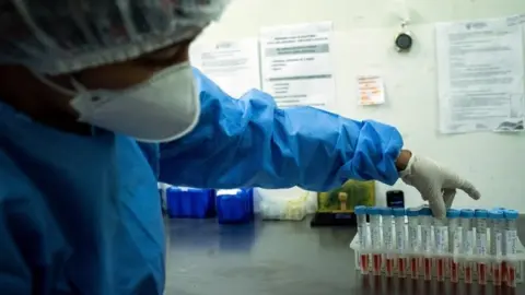 EPA A pharmaceutical professional observes samples of suspected patients with COVID-19 at the Central Laboratory of Amazonas (LACEN), in Manaus, Brazil, 31 March 2021.