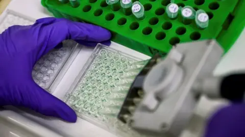 Reuters A scientist prepares protein samples for analysis in a lab at the Institute of Cancer Research in Sutton