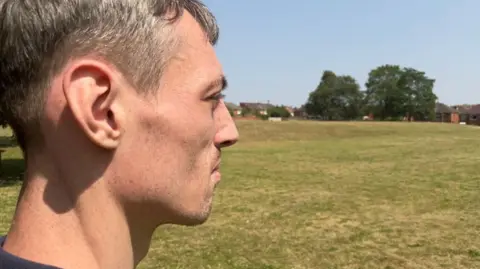 Man looks into the distance in a park. It is a clear, bright day. It is his side profile, with a neutral expression on his face.