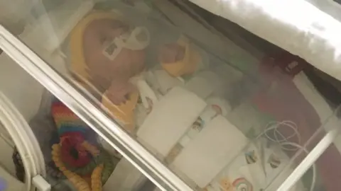 Birmingham Children's Hospital Arlo being transferred