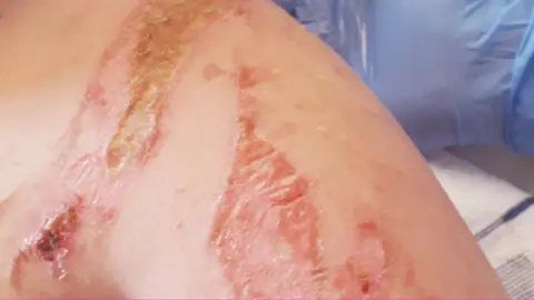 Wojtek Rudalski Charles' shoulder