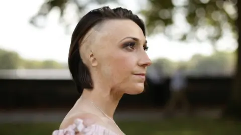 PA Adele Bellis's former partner paid another man to carry out an attack using acid.