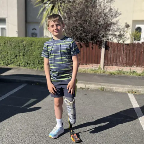 A boy stands on a residential street in the sunshine with two cream coloured houses in the background and a large bush behind a brown fence. He is smiling at the camera and wearing a grey and yellow patterned sports top and grey shorts. He has a prosthetic blade on his left leg and on his right he is wearing a blue and white trainer. 
