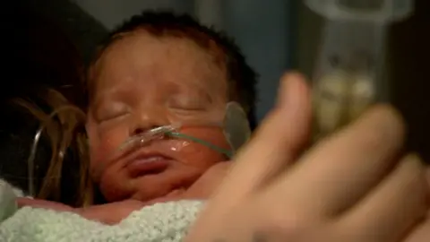 baby in NICU