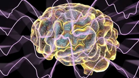 Getty Images brain