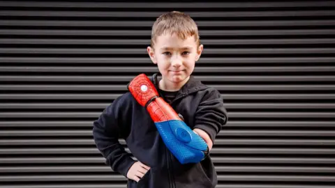 Boy, 7, born with one arm is all smiles as he holds fishing rod in two  hands thanks to £13,000 bionic limb