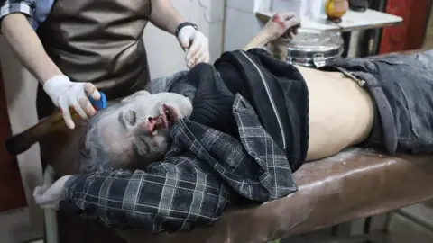 AFP An injured man is treated at a clinic in the rebel-held town of Hezzeh after a reported attack by Syrian government forces (15 March 2018)