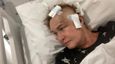 Zelda Wilson Zelda Wilson in hospital after brain surgery