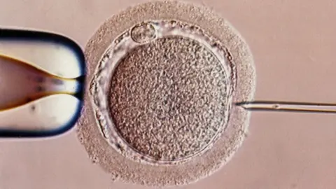 SPL File image of IVF