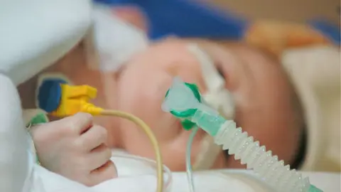 Science Photo Library Sick baby being intubated