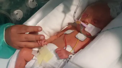 AFP Baby Scarlett-Rose