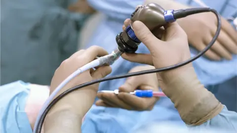 Getty Images Endoscopy procedure