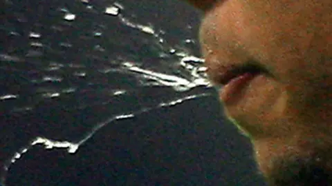 Getty Images Man spitting