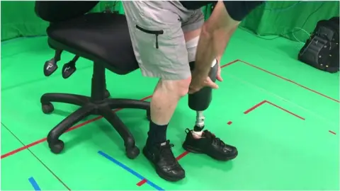 John putting on his prosthetic