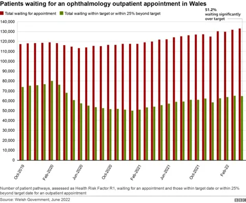 Eye waiting times chart