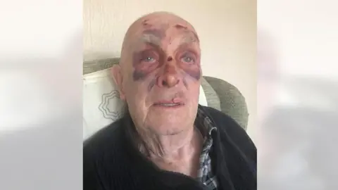 84-year-old John Miller after he was hit by an illegal bike
