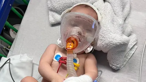 Baby Isla in hospital wearing a mask to help her breathe and she is surrounded by tubes 