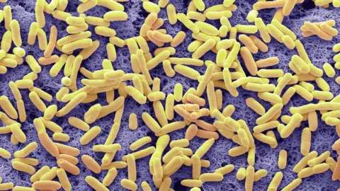 Science Photo Library E. coli