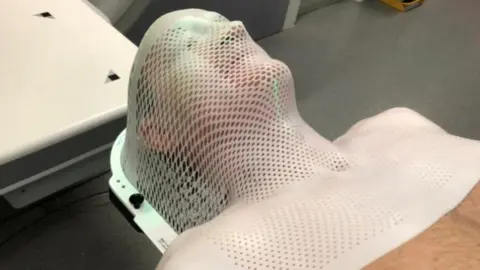 UHBW Cancer patient Colin Reilly