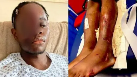 Family photo K-Dogg, victim of Bristol race attack injuries