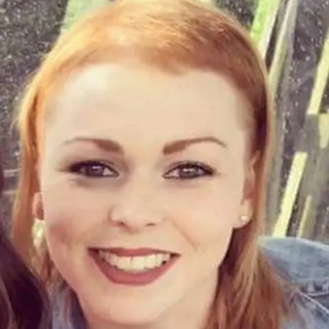 Katie Hawthorne a woman shows her hair loss