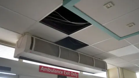 Missing ceiling panels at North Tees hospital