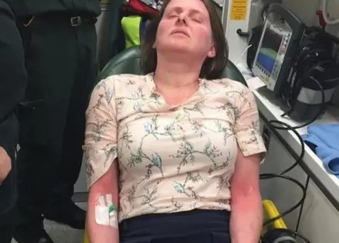 Ruth Holroyd Ruth Holroyd pictured last year after suffering a severe allergic reaction to the dairy restaurant meal