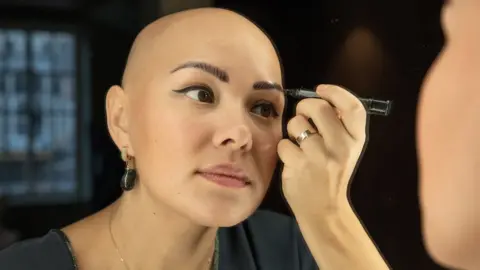 Getty Images Woman with alopecia