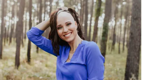 Frost Collective Makenzee was diagnosed with alopecia when she was eight years old