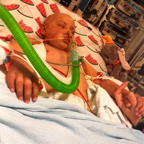 Mark Bissett charly in intensive care - A person lies in a hospital bed connected to medical equipment, including a green breathing tube and multiple monitoring lines. The person’s hands rest on the bedding, with one hand being held by someone beside the bed. The bedding features a watermelon-patterned pillow, and a stuffed toy is positioned near the person’s shoulder. Medical devices and monitors are visible in the background.