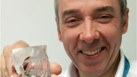 Abertawe Bro Morgannwg University Health Board Peter Llewelyn Evans with a 3D printed implant for a fractured eye socket